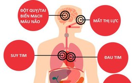 Nếu mang bệnh này, hãy cảnh giác "cái chết bất ngờ" có thể đến vào tháng 2, tháng 7