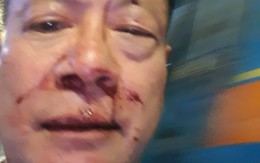 Việt kiều Đức gốc Hoa vô cớ bị nhóm thanh niên đánh trong quán karaoke ở Sài Gòn