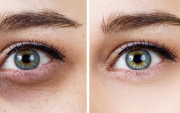 Những dấu hiệu bất thường trên cơ thể tố cáo sức khỏe bạn đang có vấn đề trầm trọng