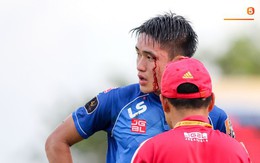 Máu đổ ròng ròng trên mặt trung vệ U22 Việt Nam trong trận đấu ở vòng 23 V.League 2019