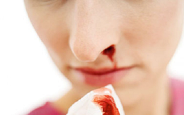 Ngạt một bên mũi lâu ngày: Dấu hiệu cảnh báo căn bệnh ung thư nguy hiểm