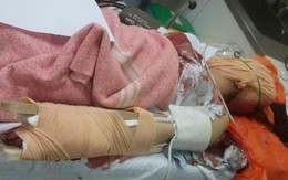 Người đàn ông 43 tuổi chém trọng thương người tình 8X sau chầu nhậu