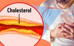 7 dấu hiệu tắc động mạch nguy hiểm mà chúng ta thường bỏ qua