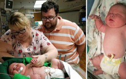 Bác sĩ 30 năm tay nghề “sốc nặng”khi đỡ đẻ cho một trẻ sơ sinh khổng lồ nặng gần 7 kilogram