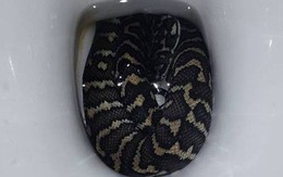 Bị rắn trong bồn cầu cắn khi đi vệ sinh