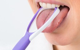 Phát hiện ung thư nhờ… kiểm tra lưỡi