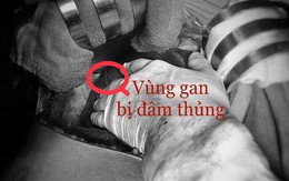 Bị đâm suýt chết vì tranh cãi bà Táo thương ông Táo nào nhất