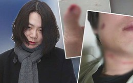 Ái nữ nhà Korean Air lộ clip mắng con thậm tệ, chồng phản pháo về cáo buộc nghiện rượu khiến hôn nhân đổ vỡ