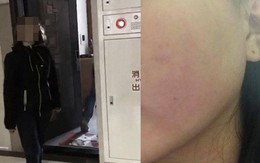 Mẹ chồng phù thủy đánh đập con dâu, cư dân mạng phẫn nộ đòi công bằng nhưng không quên chỉ trích người chồng bất lực