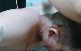 Mâu thuẫn với hàng xóm, quăng “bom xăng” khiến 4 người bị thương