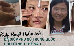 Những cô gái "đập mặt xây lại" ở Trung Quốc: Đời sang trang nhờ diện mạo mới đến nỗi xem bác sĩ thẩm mỹ là cha mẹ thứ 2