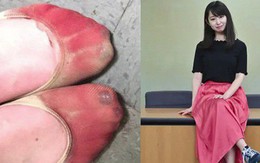 Phong trào #KuToo: Đôi chân rớm máu vì giày cao gót và lời kêu cứu của phụ nữ Nhật Bản chốn công sở