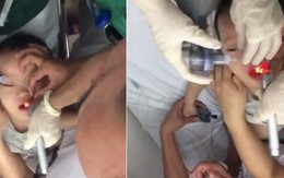 Hơn 15 phút “căng não” cấp cứu bé trai 2 tuổi ngưng thở khi bị hóc thạch rau câu