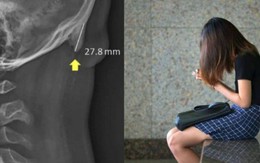 5 chứng bệnh lạ chỉ xuất hiện "nhờ" sự tồn tại của smartphone: Hội chứng cuối gần như ai cũng từng gặp phải