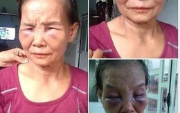 Con dâu mới sinh đánh mẹ chồng 65 tuổi sưng tím mặt rồi lại ngồi xuống khóc lóc xin lỗi, mong mẹ "đừng nói với ai"