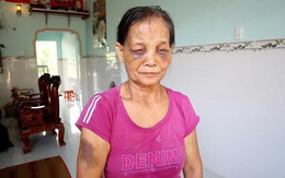 Vụ con dâu đánh mẹ chồng sưng tím mặt: Con dâu ân hận xin lỗi nhưng mẹ chồng chưa chấp nhận cho về nhà