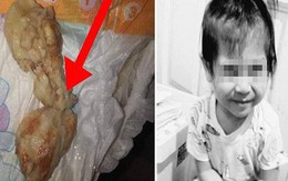 Gửi con cho người giữ trẻ, 4 ngày sau bà mẹ chết lặng nhận xác con về chỉ vì mẩu bánh mì