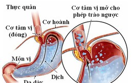 Bài thuốc trị bệnh trào ngược dạ dày thực quản