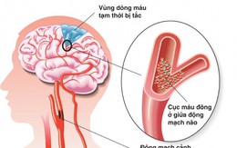 3 bệnh lý mạch máu nguy hiểm không thể bỏ sót