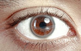 9 dấu hiệu bất thường trên đôi mắt cảnh báo bệnh tật nguy hiểm