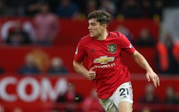 Daniel James chàng tý hon mang dòng máu Quỷ