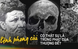 Bệnh phong: Rốt cuộc là sự trừng phạt của Thượng đế  hay của con người với nhau?