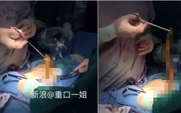 Trung Quốc: Bạn đểu chơi khăm khiến lươn chui tọt vào hậu môn của cậu trai trẻ tuổi