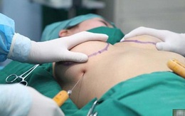 Cô gái trẻ ở TP HCM bị vỡ 2 túi độn ngực cùng lúc