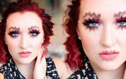 Phẫu thuật thẩm mỹ để có đôi môi lượn sóng: Xu hướng làm đẹp kì quái đang khiến các cô gái Nga phát cuồng