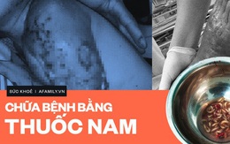 Năm 2019: Nhiều ca bệnh biến chứng nặng nề vì chữa bệnh theo tin đồn bằng thuốc nam và lời cảnh báo của chuyên gia!