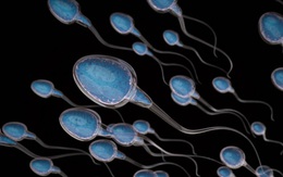 10 "sát thủ" khiến tỷ lệ sống của tinh trùng giảm: Nam giới nên chú ý ngay từ khi còn trẻ