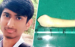 Nhổ được hai cái răng cho bệnh nhân, nha sĩ bất ngờ phá kỷ lục Guinness với chiếc răng dài nhất thế giới