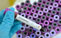 Nhóm nghiên cứu Hà Lan tìm ra kháng thể chống virus corona