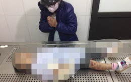 Hà Nội: Bé gái 3 tuổi tử vong, trên cơ thể nhiều vết bầm tím nghi bị bạo hành