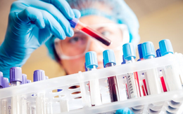 [Infographic] Cập nhật tình hình dịch bệnh Covid-19 ngày 19/4/2020