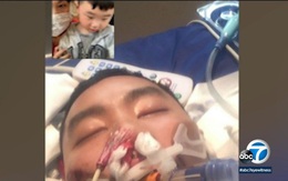 Người gốc Việt tử vong vì Covid-19 ở California