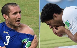 Bị Suarez cắn vào vai, Chiellini nói không giận đối thủ