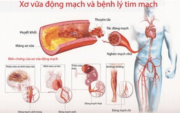 Một số chứng bệnh tim nguy hiểm thường gặp