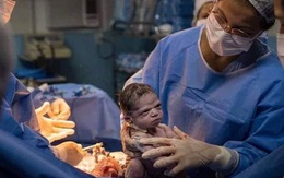 Hình ảnh em bé vừa chào đời đã "lườm xắt xéo" bác sĩ khiến cư dân mạng được một trận cười thả ga
