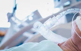 Tình báo Israel nói về cuộc chiến giành giật máy thở toàn cầu trong dịch COVID-19