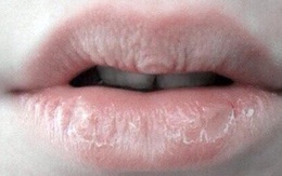 Nếu cơ thể có 4 dấu hiệu nhỏ này trên môi, mặt, tay, chân thì bạn cần kiểm tra sức khỏe ngay