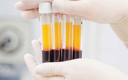 Covid-19: Hai người bệnh nặng hồi phục sau khi điều trị bằng huyết tương