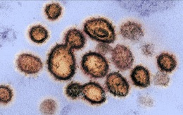 Một người Đức gốc Việt tử vong do COVID-19