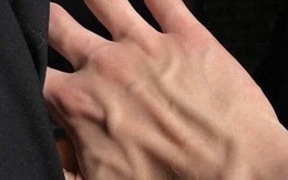 Tự kiểm tra sức khỏe mạch máu tại nhà theo cách đơn giản chỉ với ngón tay và 3 bước thực hiện