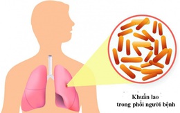 Các bệnh dễ nhầm với lao phổi