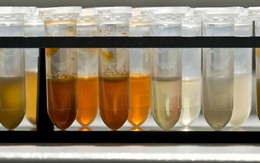 Uống thuốc trị Covid-19 tự chế, dược sĩ thiệt mạng, ông chủ nguy kịch