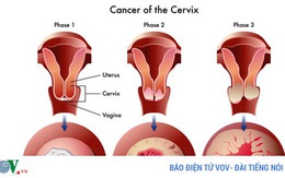 10 căn bệnh giết người thầm lặng mà bạn phải biết