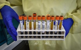 Italy đang nghiên cứu 5 - 6 loại vaccine triển vọng phòng COVID-19