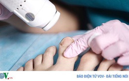 Móng tay nói những điều gì về sức khỏe của bạn?