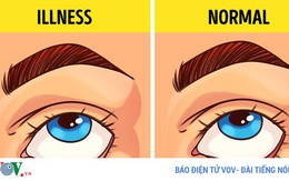 Một số mẹo đơn giản để biết tình trạng sức khỏe của bạn